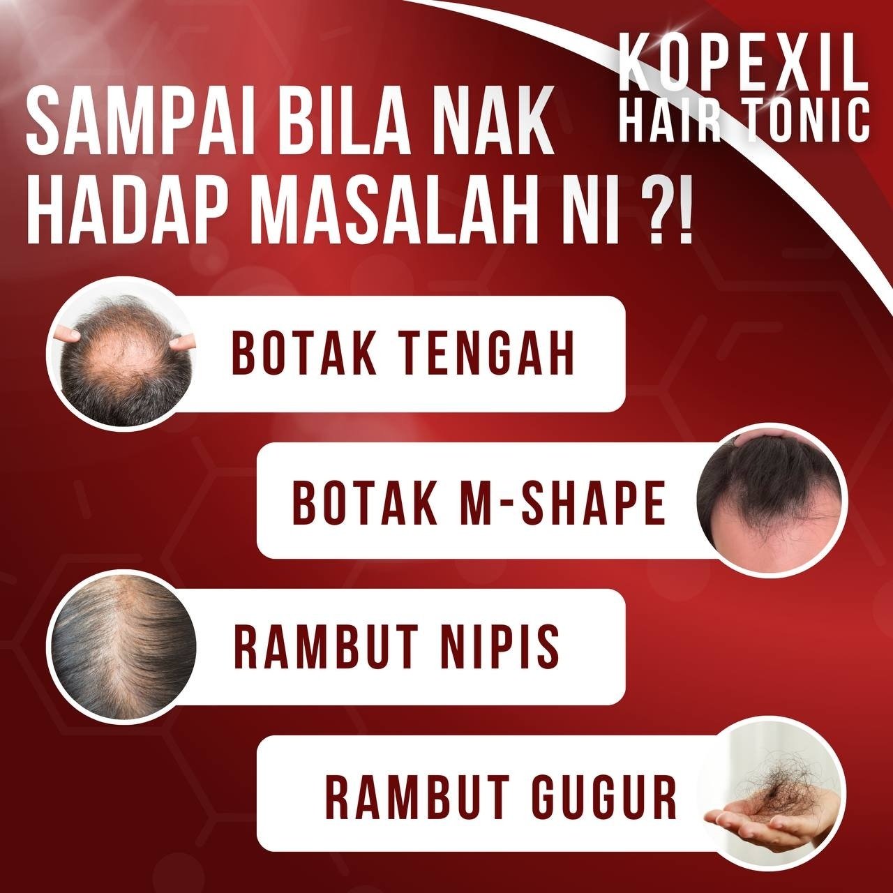 Masalah Rambut