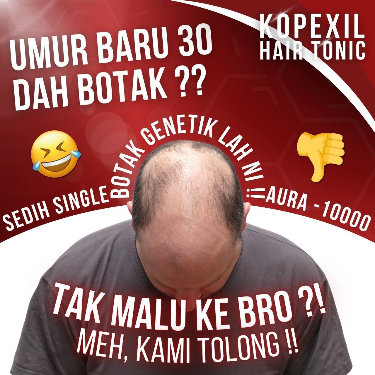Masalah Rambut Serius